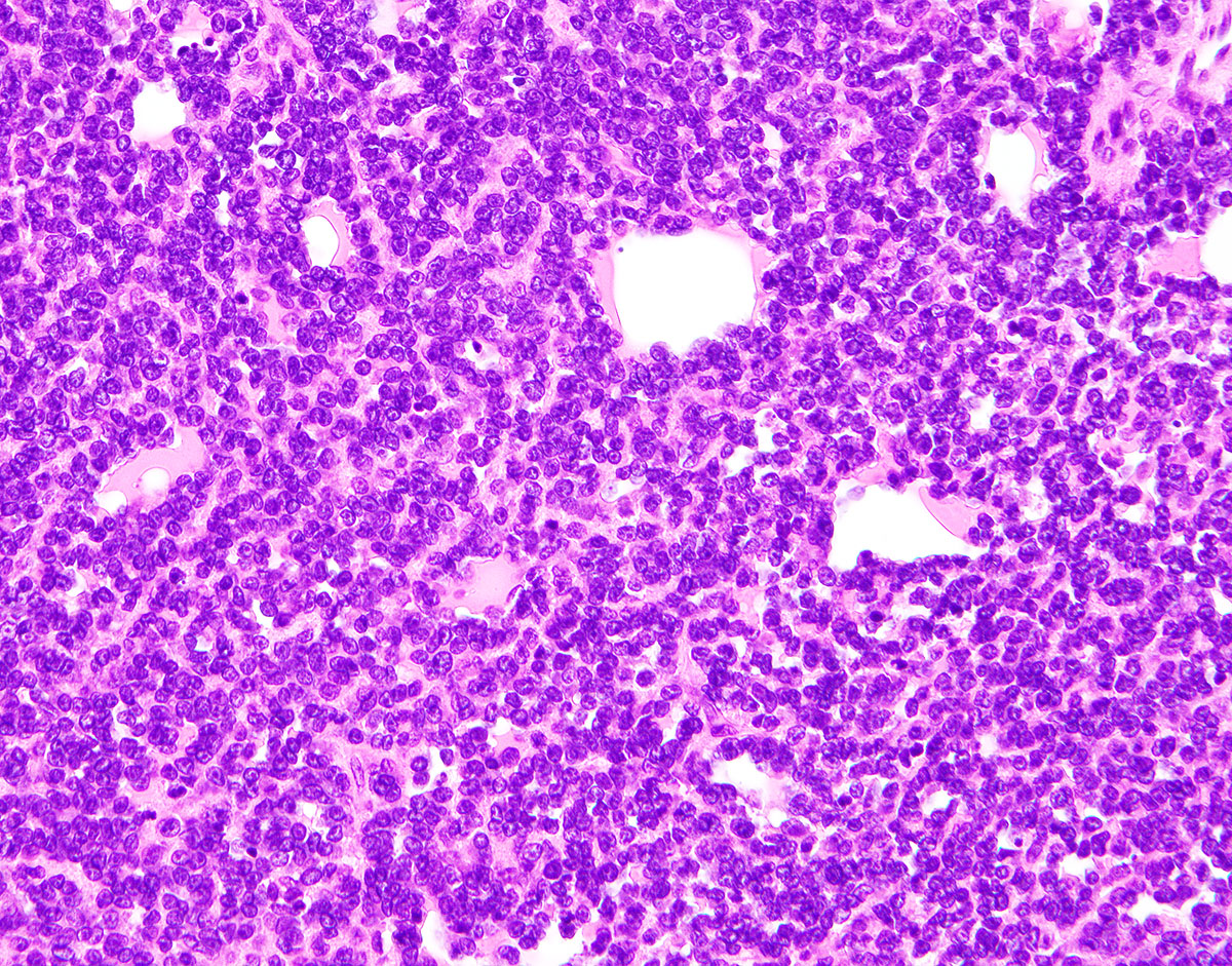 Brigham and Women's Pathology tweet media