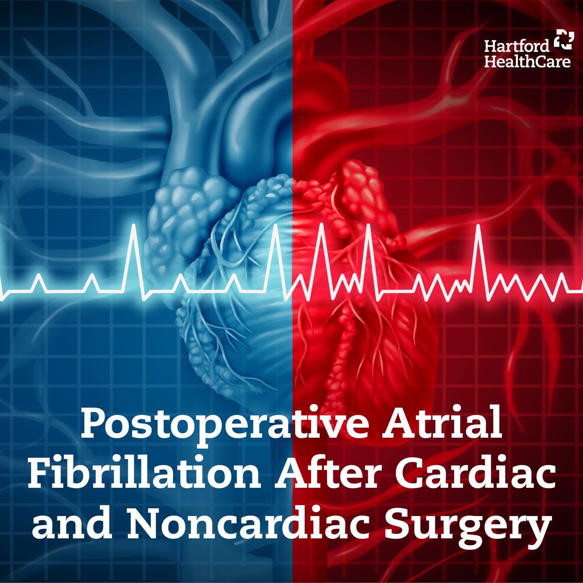 We would like to invite cardiologist and electrophysiologist in a short survey (<5 mins) study to understand the trend of managing patients with postoperative atrial fibrillation on an outpatient basis. Please take a moment to complete & share. Thank you. redcap.hhchealth.org/surveys/?s=3DK…