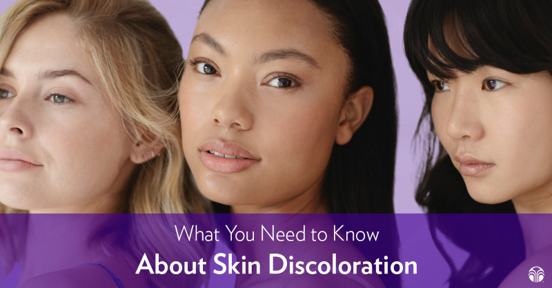 nuskin's tweet photo. Skin discoloration is a concern for many people who are left with questions of why and how it happens. 🤔 Nu Skin scientists have researched this issue in order to give YOU answers. Learn more by clicking the link below. 
#skindiscoloration #hyperpigmentation #melanin #NuSkin
