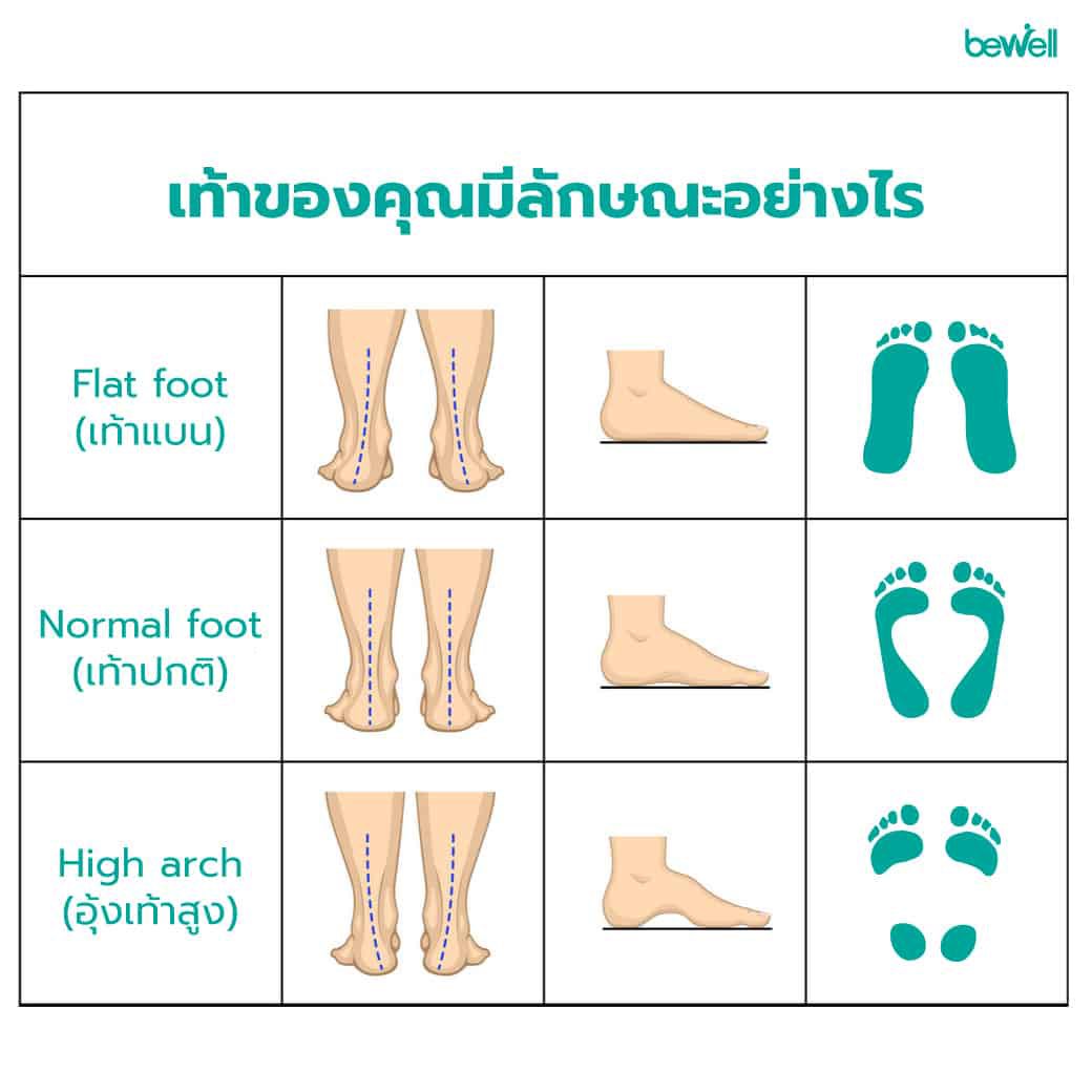 เท้าแบน เป็นอาการที่เป็นตั้งแต่เกิด หรือเป็นเพราะเกิดจากการบาดเจ็บ เลยทำให้เดินและทรงตัวในลักษณะนี้ จะปวดเท้าเมื่อยเท้าบ่อย แม้จะเปลี่ยนเป็นรองเท้าวิ่งแล้วก็ตาม นวดก็แค่บรรเทาชั่วคราว คุณหมอเลยแนะนำให้ทำแผ่นรองรองเท้าไว้บังคับเท้าให้ไปในลักษณะการยืนและเดินที่ถูกต้อง