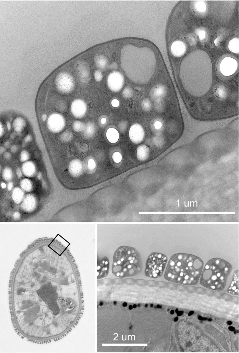 Des bactéries cubiques découvertent en Guadeloupe! Elles recouvrent le nématode marin Catanema sp. Elles vont nous aider a comprendre les mecanismes de la croissance et de la division cellulaire des bactéries. #biodiversite #DitGustave <a href="/UnivAntilles/">UnivAntilles</a> tinyurl.com/ssw4rnxm