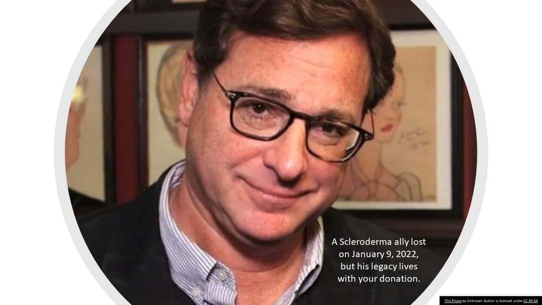 MBScleroderma's tweet photo. Bob Saget, a great scleroderma ally, lives in your donation to support your local scleroderma organization.
Visit https://t.co/YUkrXGje4N
Jimmy’s Kimmel's moving tribute to the great @bobsaget… https://t.co/WbLxBsmJFl
#lookingforwardwithhope #scleroderma https://t.co/0h5n8O2U9U