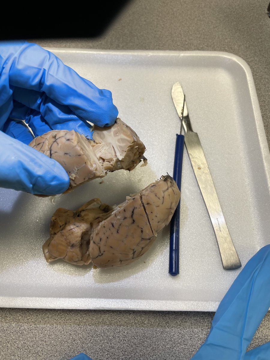 STEM7thWCMS's tweet photo. Students in 7th Grade CVA got an opportunity to virtually be a part of the Sheep Brain Dissection. They successfully compared a human brain to a sheep brain! #STEMinCVA #STEMrocks #chargedup #cvachargers 
@ColliervilleVi1 @teachtheville @TeachingSTEM https://t.co/OLdihMCYE0