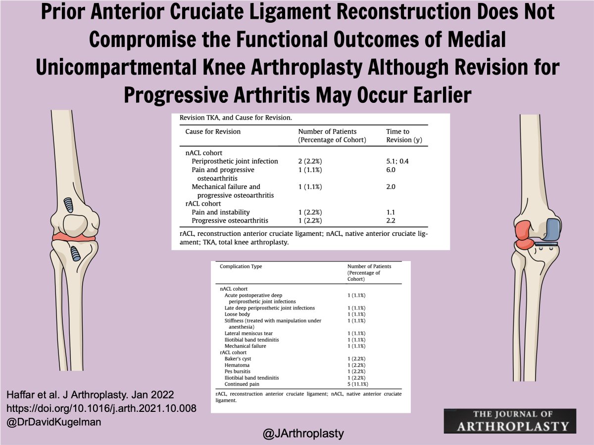 The Journal of Arthroplasty (@jarthroplasty) on Twitter photo #UKA after #ACL reconstruction: Longterm outcomes are needed.
doi.org/10.1016/j.arth…
<a href="/RothmanOrtho/">Rothman Orthopaedics</a> <a href="/MOR_Docs/">Midwest Orthopaedics at Rush</a> <a href="/AndersonClinic/">Anderson Clinic</a>
<a href="/DrChadKrueger/">Chad A Krueger, MD, FAAOS</a> @AOSSM_SportsMed #UKA after #ACL reconstruction: Longterm outcomes are needed.
doi.org/10.1016/j.arth…
<a href="/RothmanOrtho/">Rothman Orthopaedics</a> <a href="/MOR_Docs/">Midwest Orthopaedics at Rush</a> <a href="/AndersonClinic/">Anderson Clinic</a>
<a href="/DrChadKrueger/">Chad A Krueger, MD, FAAOS</a> @AOSSM_SportsMed