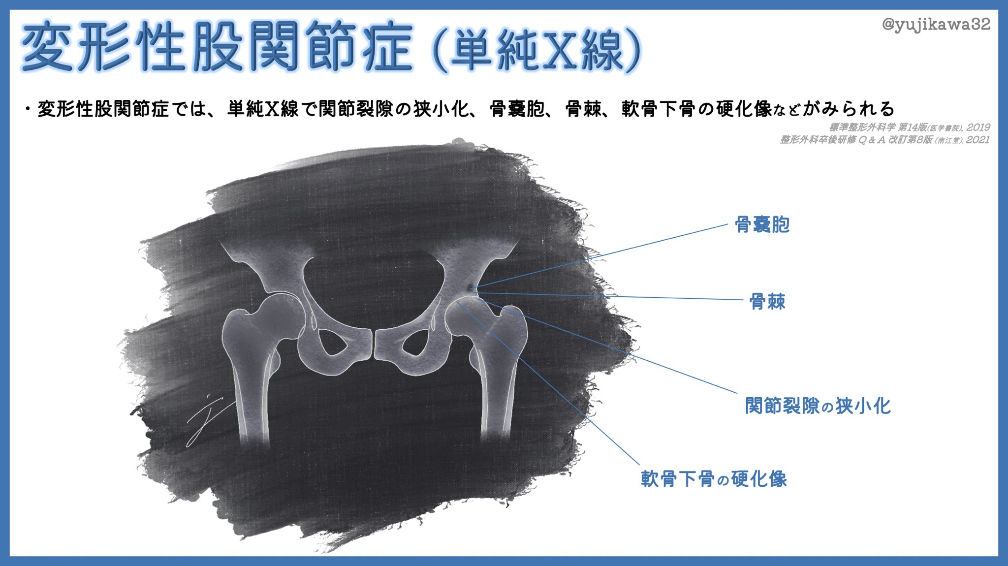 標準整形外科学 第14版 標準整形外科学 第14版 | 書籍詳細 | 書籍 | 医学書院