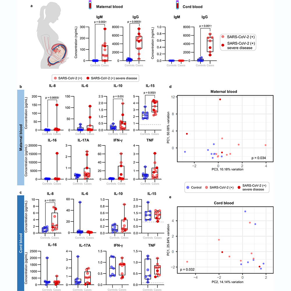 NaturePortfolio's tweet photo. SARS-CoV-2 exposure during pregnancy prompts a placental inflammatory response involving both maternal and foetal cells, but does not infect the placental tissue, suggests a study published in @NatureComms. https://t.co/2POXrTsm3y https://t.co/4KGADF1DXo