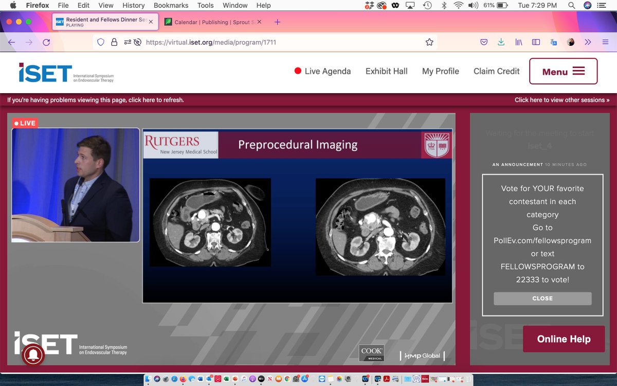 cookvascular's tweet photo. Peripheral embolization: Dr. Aleksander Kubiak presents "Coil Embolization of a Pancreaticoduodenal Artery Aneurysm" at #FellowLuminaries during #ISET2022. 
@ajkubs #TheAmazingCase @Rutgers_NJMS https://t.co/6ktI82XIsR