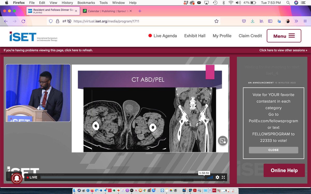 Cook Vascular (@cookvascular) on Twitter photo Iliofemoral venous obstruction: Dr. Denzel Cole presents “Treatment of Iliocaval Venous Obstruction in an Office Laboratory Setting” at #FellowLuminaries during #ISET2022.
<a href="/dcoleir/">Denzel Cole, MD</a> #TheAmazingCase <a href="/Flendovasc/">Curtis Anderson, MD, PhD, FSIR</a> <a href="/LARKINHOSPITAL/">Larkin Hospital</a> Iliofemoral venous obstruction: Dr. Denzel Cole presents “Treatment of Iliocaval Venous Obstruction in an Office Laboratory Setting” at #FellowLuminaries during #ISET2022.
<a href="/dcoleir/">Denzel Cole, MD</a> #TheAmazingCase <a href="/Flendovasc/">Curtis Anderson, MD, PhD, FSIR</a> <a href="/LARKINHOSPITAL/">Larkin Hospital</a>