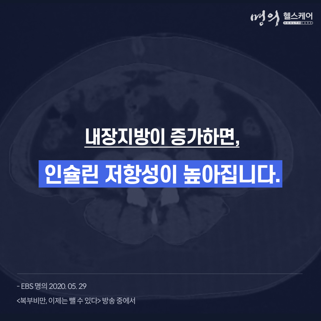ebs_bestdoctors's tweet photo. 우리 몸에 지방 조직이 과다한 상태를 비만이라고 합니다. 특히 칼로리가 높은 식품이 풍부하고 신체 활동을 덜 해도 사는데 불편이 없는 현대의 생활환경이 비만의 폭발적 증가를 초래하고 있죠.
다시보기 ▶https://t.co/PPSKf2OSfy
#명의​​​​​​​ #EBS명의
#복부비만 #건강상식 https://t.co/7OHx5EFUJm
