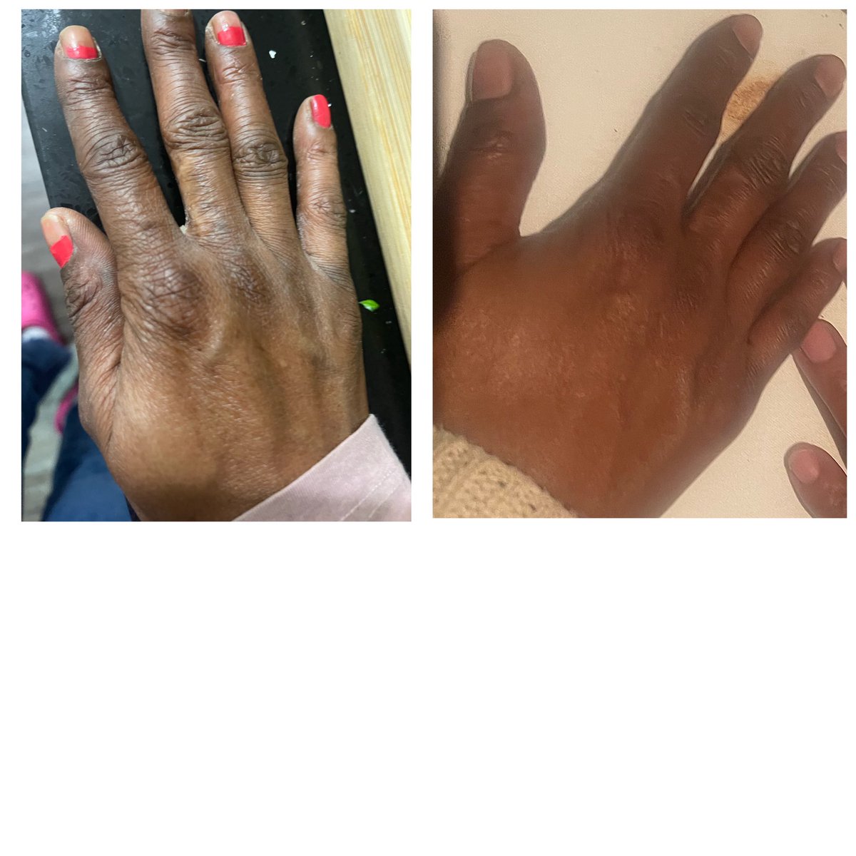 Glow Skin Enhancement tweet media