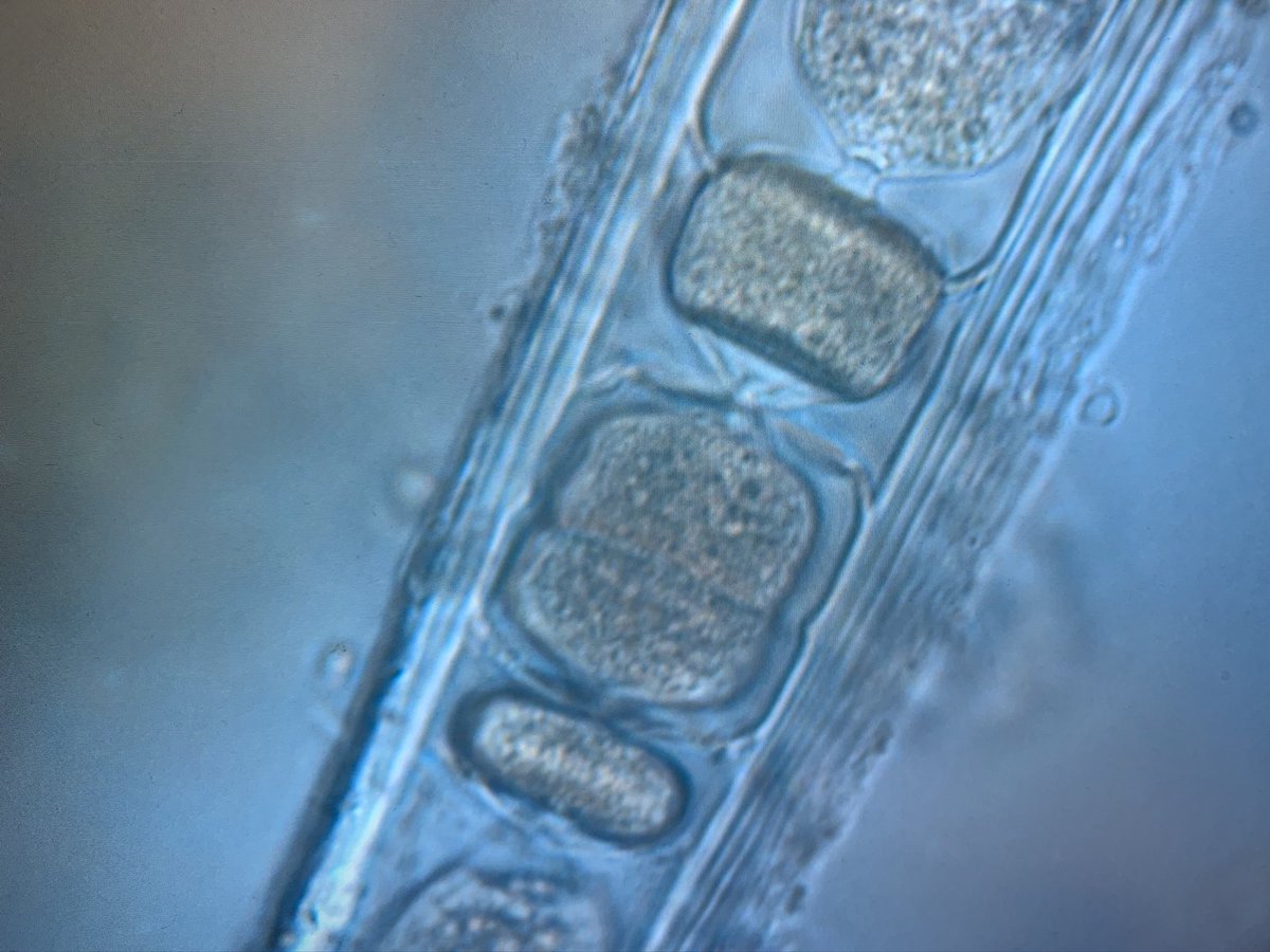 IndoPacScarini's tweet photo. In my #marine_biology #phd after extracting #coral_reef cores where #parrotfish 🦜 🐠 bite. I then take photos 📸 with the microscope 🔬 to quantify & identify biota. In the last year I have extracted DNA 🧬 from my bite cores. #next_generation_sequencing 16S: cyanos & 18S: algae https://t.co/Zak6tgj7Wd