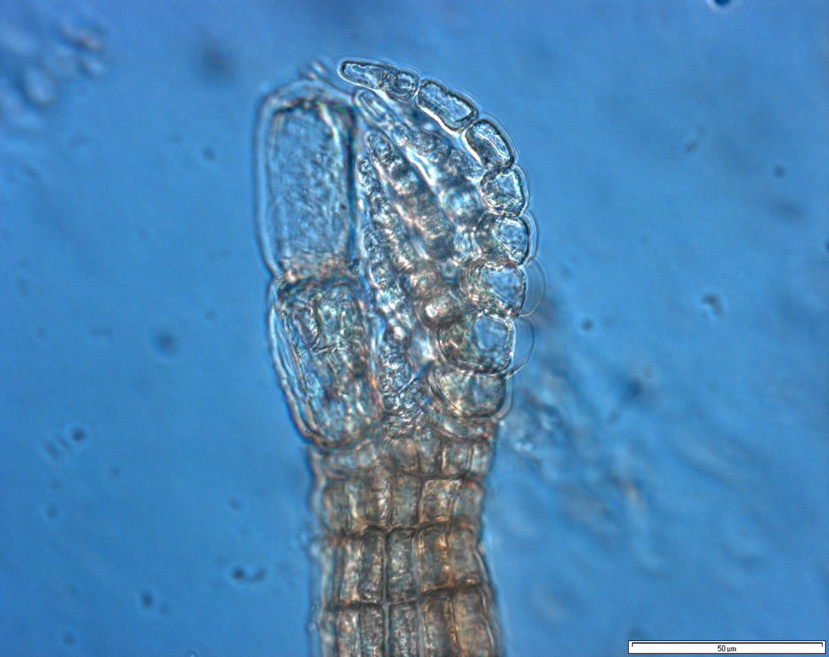 IndoPacScarini's tweet photo. In my #marine_biology #phd after extracting #coral_reef cores where #parrotfish 🦜 🐠 bite. I then take photos 📸 with the microscope 🔬 to quantify & identify biota. In the last year I have extracted DNA 🧬 from my bite cores. #next_generation_sequencing 16S: cyanos & 18S: algae https://t.co/Zak6tgj7Wd