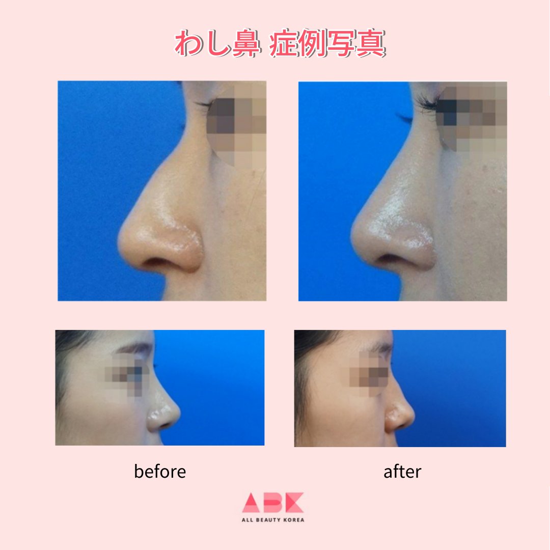 美人鼻 Twitter Search Twitter