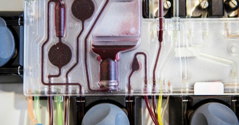 NatureCustom's tweet photo. For blood stem cell transplant candidates, a new application of an existing chemotherapy could significantly increase the odds of finding a suitable donor. #Adfeature with @BeTheMatch