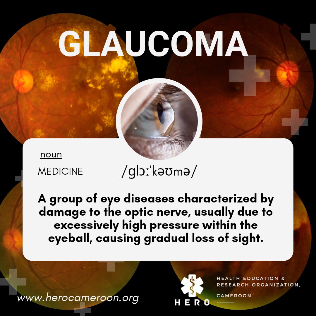 The eyes are the window of the soul and indicates the antiquity thereof. Glaucoma is one of the conditions that can snatch this opportunity. More information on the flyer.
#eyecare
#savesight
#HEROCameroon