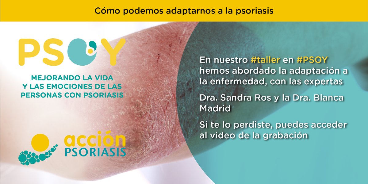 accionpsoriasis's tweet photo. El 53% de los pacientes que padecen de #psoriasis presentan un caso moderado-grave.

Con las psicólogas @SandraRosPsico  y @bmadrida  abordamos la adaptación a la enfermedad en la primera edición de #PSOY.

📽️Accede a la grabación aquí 👉 https://t.co/AcIulTC77W https://t.co/Te9P66Qg6c