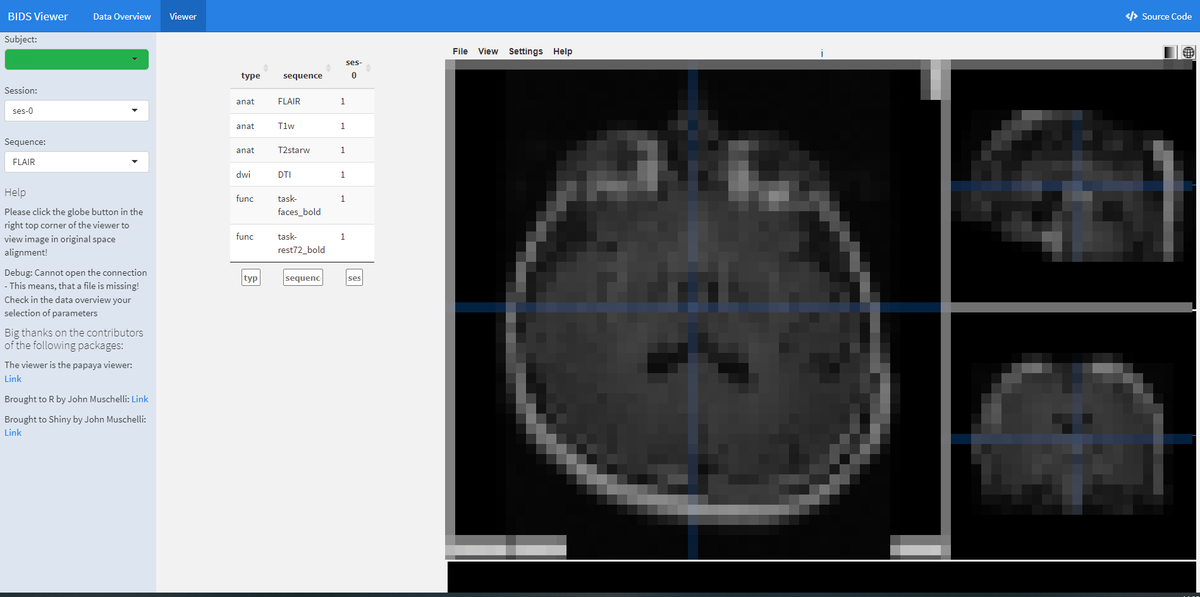 NiklasWulms's tweet photo. If you want to try out an easy to use viewer (papayaWidget by @StrictlyStat) to inspect all your BIDS data: Give the function 

'run_shiny_BIDS("path/to_your/bids_folder")' 

from the #BIDSconvertR package a try. 
#BIDS https://t.co/FMft60FH2l https://t.co/Xza09gEEjk