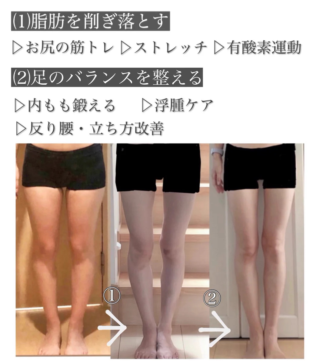 足太い原因は脂肪・浮腫や立ち方が悪い という人がほとんど。変化が表れやすいやり方。
