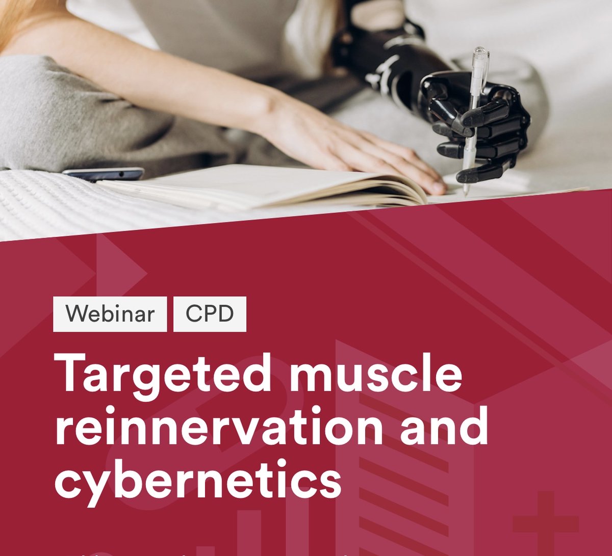 Relimb_UK's tweet photo. Today we are joining the @RoySocMed  'Targeted muscle reinnervation and cybernetics' webinar, with Norbert Kang presenting at 16:30 on 'Functional bioprostheses: Surgeon’s perspective'. Join in the conversation #RSMLive https://t.co/o2Wpy0y9Cf