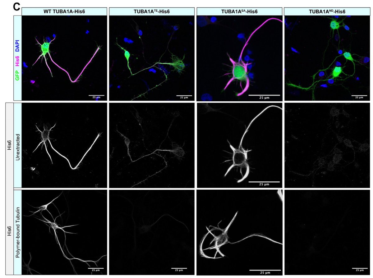 Jayne Aiken (@jayneaiken_) on Twitter photo Check out our novel method of visualizing specific tubulin isotopes and variants in cells, published today in frontiers in cell and developmental biology! frontiersin.org/article/10.338… #science #microtubules <a href="/BatesLab/">Emily Bates Lab</a> Check out our novel method of visualizing specific tubulin isotopes and variants in cells, published today in frontiers in cell and developmental biology! frontiersin.org/article/10.338… #science #microtubules <a href="/BatesLab/">Emily Bates Lab</a>