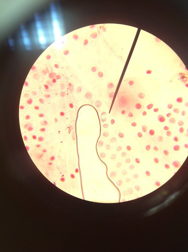 IES_M_Falla's tweet photo. Ayer, en la clase de #BioGeo, el alumnado de #4esoD intentamos cazar alguna célula en #mitosis aunque por dificultades técnicas con el calentamiento de la #orceína 🔥 no hemos podido ver la #divisióncelular en todo su apogeo. @IES_M_Falla 💪🏽💪🏽 https://t.co/8DPBpoDIk0
