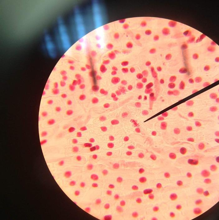 IES_M_Falla's tweet photo. Ayer, en la clase de #BioGeo, el alumnado de #4esoD intentamos cazar alguna célula en #mitosis aunque por dificultades técnicas con el calentamiento de la #orceína 🔥 no hemos podido ver la #divisióncelular en todo su apogeo. @IES_M_Falla 💪🏽💪🏽 https://t.co/8DPBpoDIk0