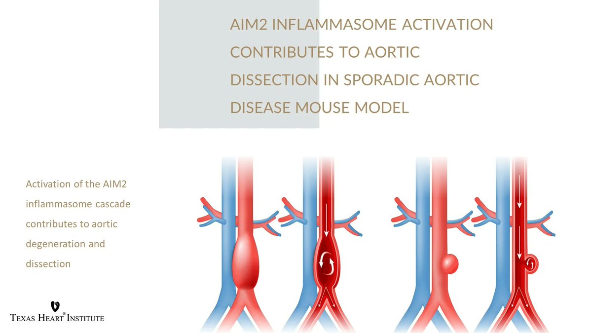 AIM2 inflammasome activation contributes to aortic dissection in sporadic aortic disease mouse model | #THIPubs @JCoselli_MD @scottlemaire @yinghshen | @JSurgRes buff.ly/3GEGbrg