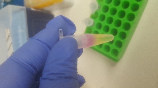 xZoeAlicex's tweet photo. Science is fascinating at the best of times but when it's in your favourite colours, it's magic 👩‍🔬🧬#MonarchPlasmidDNAMiniprepKit #DNA #Science #Favouritecolours #pink #yellow https://t.co/dH2VYA6lDD
