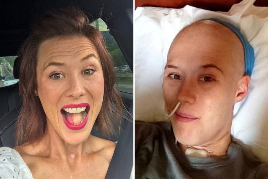 Woman's tongue replaced with thigh to fight cancer: 'It grew leg hair' trib.al/Q5Ez3Ji