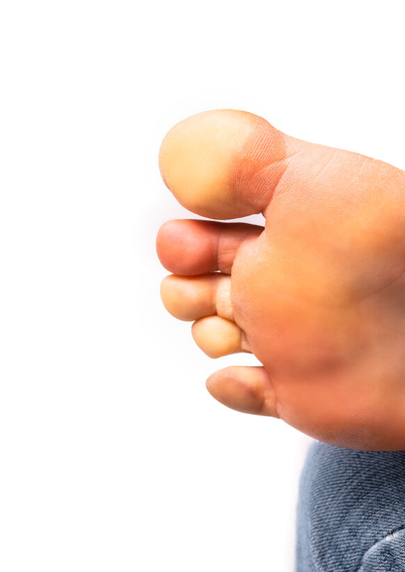 DPMPatrick's tweet photo. We hope you won't forget to care for your feet during a winter freeze. What do you know about frostnip and frostbite? We can help. https://t.co/6fVxvAUB6z

#PatrickFettingerDPMLLC #NewFairfieldCTFootDoctor #MiddleburyCTFootDoctor #WinterWeatherInjuries https://t.co/y3KjnoaPP1