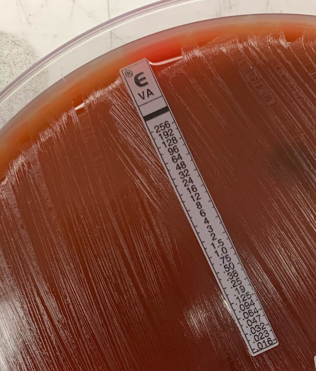 SCherianMicro's tweet photo. Mid- week Microbe! This organism is a Gram positive coccus. Check out the susceptibility of Vancomycin in the picture! What is your shortlist of possible organisms? (Who can name them all? 😆) #MicroRounds #clinmicrolab https://t.co/s8QEeDAU1B