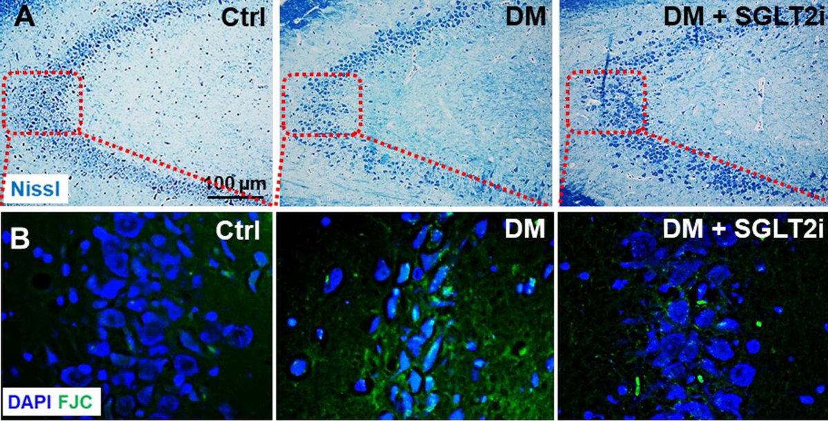 ajpheartcirc's tweet photo. Read our Special Collection on New Developments in Translational #Microcirculatory Research
📰 https://t.co/PQS4EpxNhL
#Microcirculation #Obesity #Cerebrovascular
#Vasodilation #NitricOxide
#CoronaryArteryDisease https://t.co/ORNVyoVzeb