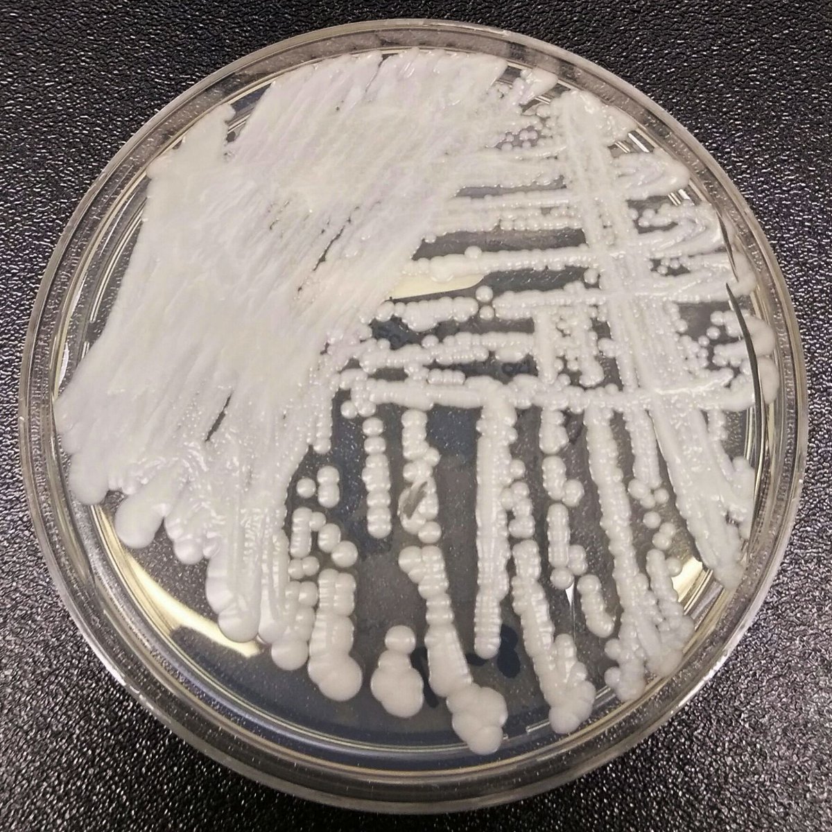 KSLA's tweet photo. A drug-resistant fungus has been found at a Louisiana hospital, marking a first for the state. The CDC says it's especially dangerous to hospital and nursing home patients with serious medical problems ► https://t.co/GH5NljzML8 (Credit: Shawn Lockhart/CDC file photo via AP) https://t.co/l8bdEcScMa