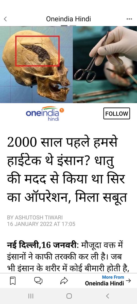yogrishiramdev's tweet photo. नमन सुश्रुत को🙏
अमेरिका के ओक्लाहोमा में स्केल्टन नाम का एक म्यूजियम है जिसमें 2000 साल पुरानी खोपड़ी में पुरातन काल की सर्जरी को दिखाया गया है,
पुरातन काल से ही भारत में महर्षि सुश्रुत ने सर्जरी के बारे में अद्भुत ग्रंथ लिखें हैं.
https://t.co/MJqLPh2IJS https://t.co/qVPhKEab6z