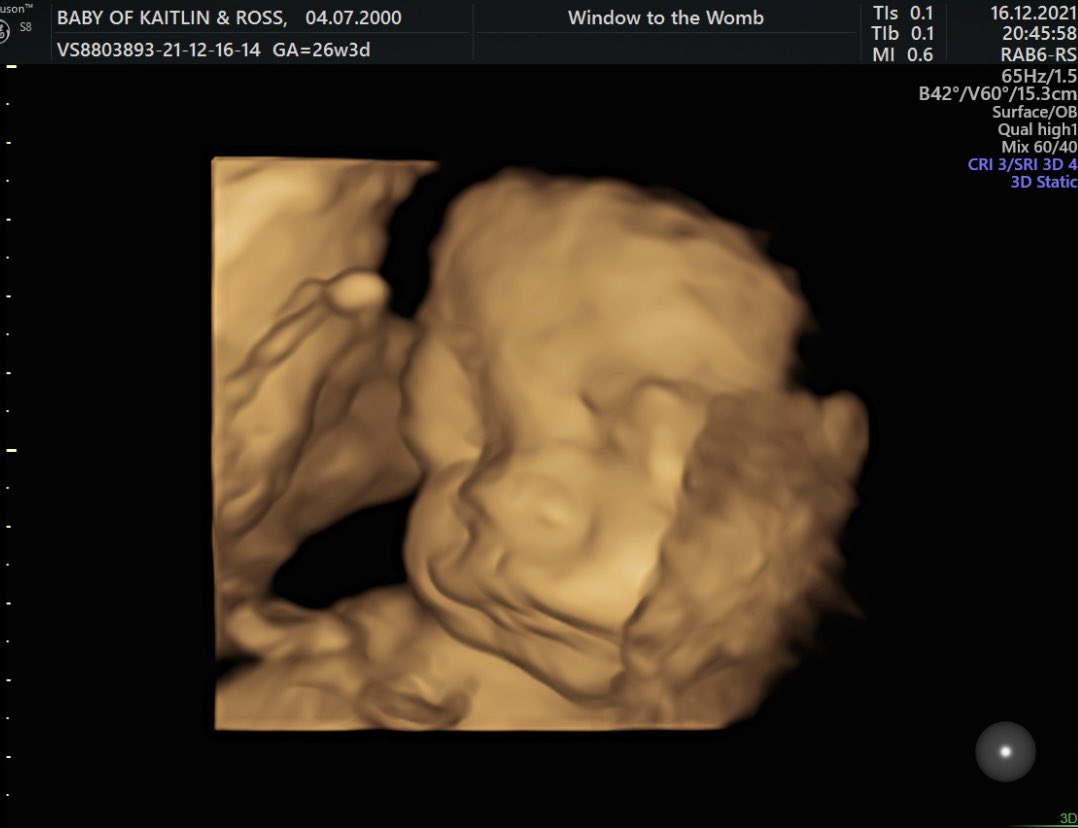 KaitlinParish5's tweet photo. A little face I will never get tired of seeing 🥰 Just over 8 weeks until you are in my arms ❤️🥺 https://t.co/xeX9pRzftD