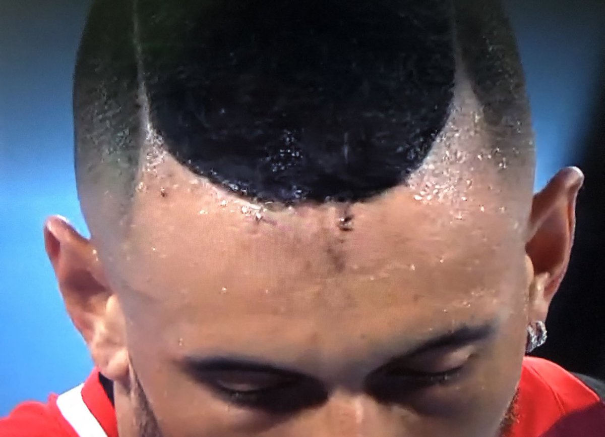 MadsGrummet's tweet photo. #Kyrgios is all id 👶🏻 = undisciplined, reactive, crude, embarrassing. He also appears to be having a literal cranial meltdown.🤷🏻♀️➿
#goMedvedev
#AustralianOpen2022 https://t.co/Cj7wEBXiEr