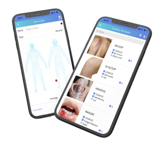 Ulcerasnet's tweet photo. La fotografía clínica nos puede ayudar registrar evolución de los pacientes y obtener datos investigación @Clinicgram solución de #saluddigital permite tomar imágenes heridas directamente desde móvil e introducir datos clínicos asociados @izasamedical https://t.co/J5NvfPfyCQ https://t.co/dQS8XQHTIX
