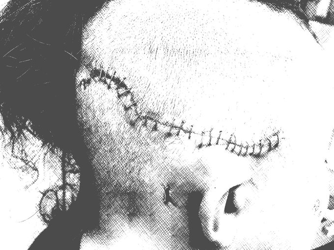 A member of our community could really use our help!  @TheeBrandiWood is a fssw who over the summer contracted<a href="/tag/sesta"class="tags"><span>#sesta</span></a><a href="/tag/fosta"class="tags"><span>#fosta</span></a>