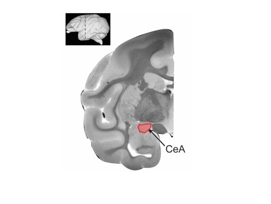 ACNP (@acnporg) on Twitter photo A recent study by <a href="/PatelReesha/">Reesha Patel</a> <a href="/fvarodayan/">Dr. Florence Varodayan</a> <a href="/MelissaHerman4/">Dr Melissa Herman</a> et al., found a surprising new link between central amygdala CRF and intoxication that suggests low CRF may predict greater severity of relapse. rdcu.be/cFjJA <a href="/npp_journal/">Neuropsychopharmacology</a> A recent study by <a href="/PatelReesha/">Reesha Patel</a> <a href="/fvarodayan/">Dr. Florence Varodayan</a> <a href="/MelissaHerman4/">Dr Melissa Herman</a> et al., found a surprising new link between central amygdala CRF and intoxication that suggests low CRF may predict greater severity of relapse. rdcu.be/cFjJA <a href="/npp_journal/">Neuropsychopharmacology</a>
