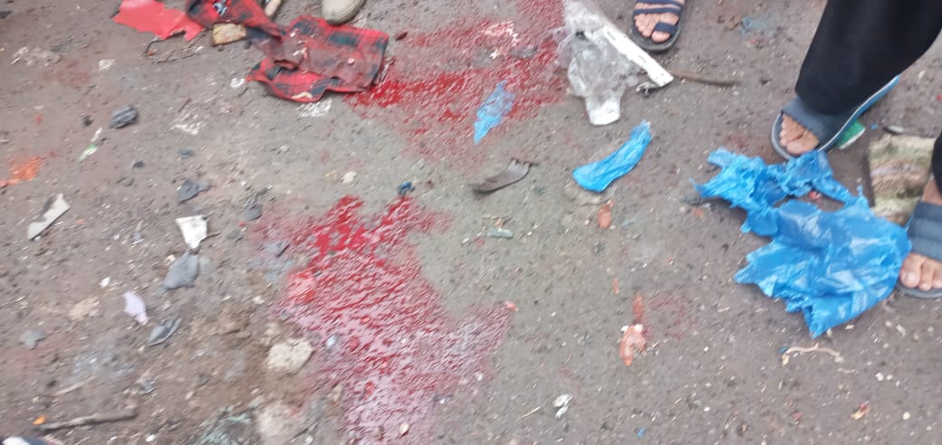 ExposeAntiIndia's tweet photo. The nature of the blast has yet to be ascertained. Forensic teams are also considering the possibility of a time-triggered improvised explosive device (#IED) and evidence from the site is being collected
#terrorist #Pakistan #AnarKaliBazaar #anarkaliblast
#PakistanMovingBackward https://t.co/RJEI7rO7Q4