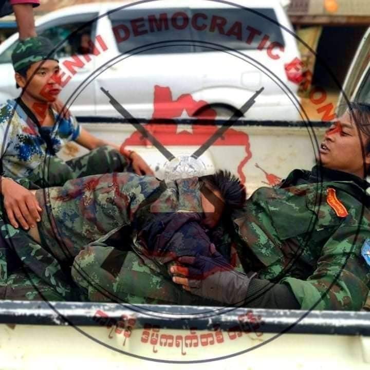 Haruonchill's tweet photo. A comrade from Karenni Democratic Front was SHOT by the junta sniper as the clash broke out while conducting clearance operation in #Karenni State today. He was reportedly in CRITICAL condition and KDF also warned locals to evade junta’s possible arrests.
#WhatsHappeningInMyanmar https://t.co/Dj9jM2K60x