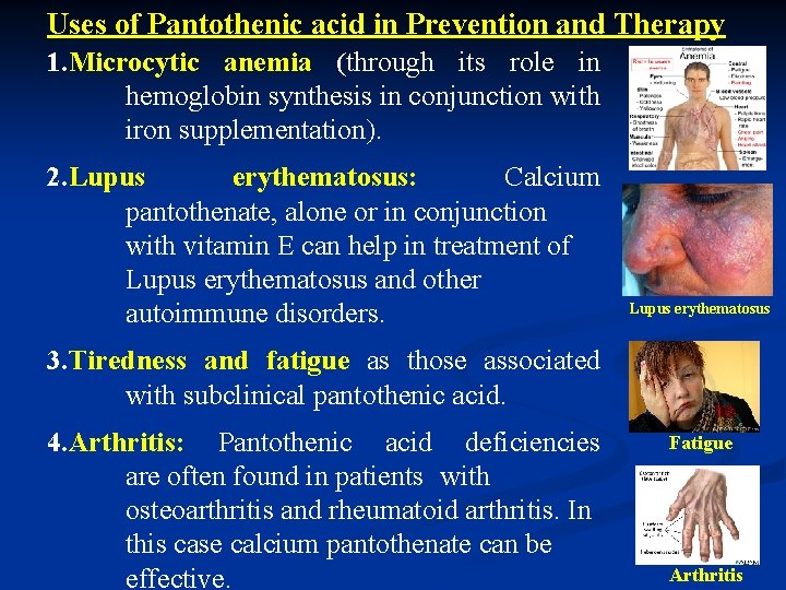 Pantothenic Acid Deficiency