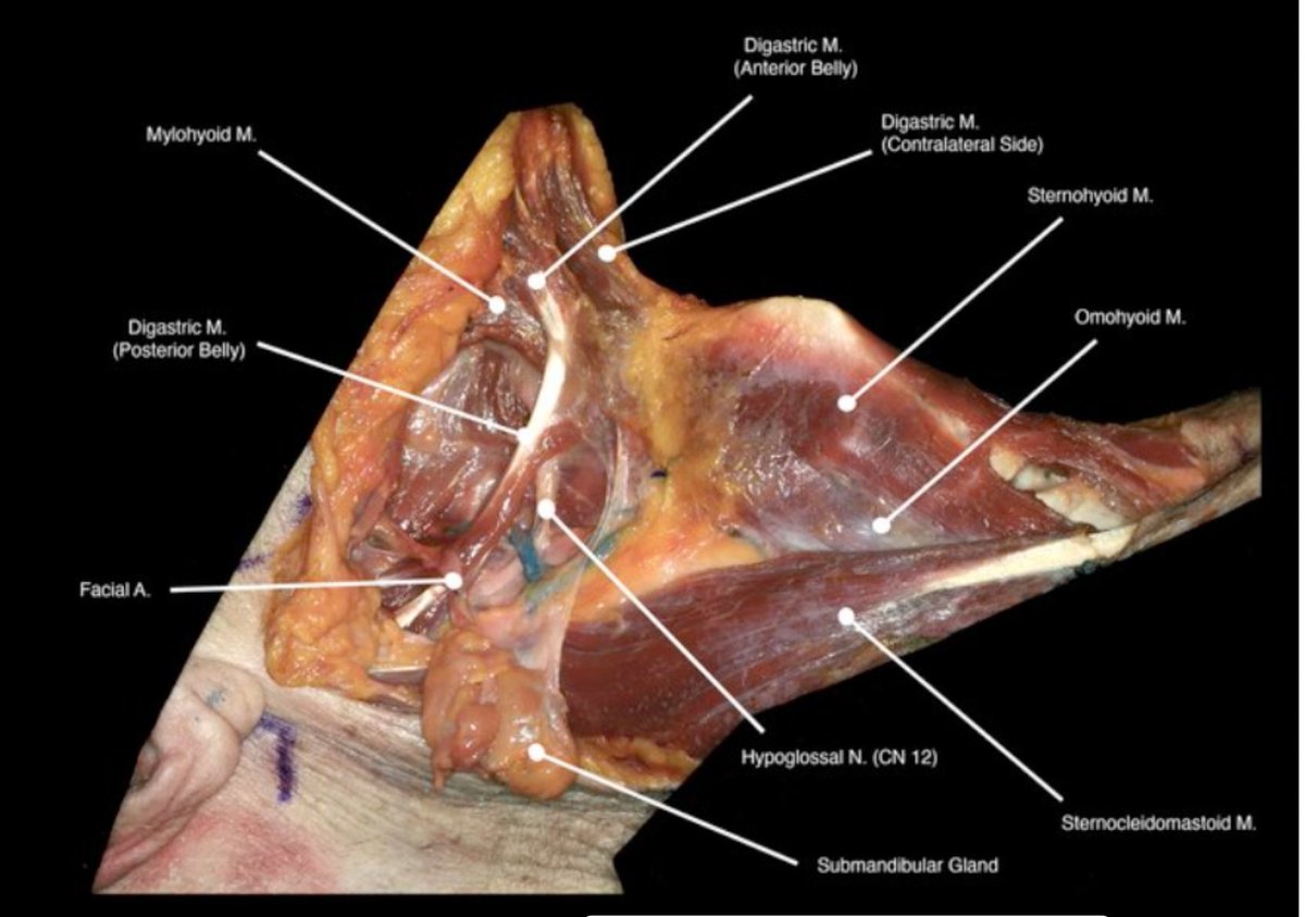 Headmirror.com (@headmirror_com) on Twitter photo 3D Anatomy Atlas Update! See all new chapters on tracheostomy and neck dissection in high resolution 2D and 3D! <a href="/CheyanneSilver/">Cheyanne Silver MD</a> <a href="/LindaXYinMD/">Linda Yin, MD</a> K Tasche and <a href="/KatieVanAbelMD/">Katie Van Abel (she/her(s))</a>. #meded #entsurgery #Anatomy; headmirror.com/headneck-atlas… 3D Anatomy Atlas Update! See all new chapters on tracheostomy and neck dissection in high resolution 2D and 3D! <a href="/CheyanneSilver/">Cheyanne Silver MD</a> <a href="/LindaXYinMD/">Linda Yin, MD</a> K Tasche and <a href="/KatieVanAbelMD/">Katie Van Abel (she/her(s))</a>. #meded #entsurgery #Anatomy; headmirror.com/headneck-atlas…