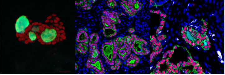 ScreenedH's tweet photo. 🎯Today, at the 2022 @EurionCluster Annual meeting, ULB presented its protocol to produce human thyroid #organoids from #hESCs. 
👏Very nice work, that you can read at https://t.co/nLa59ftshh https://t.co/0wPFwcT7Tw