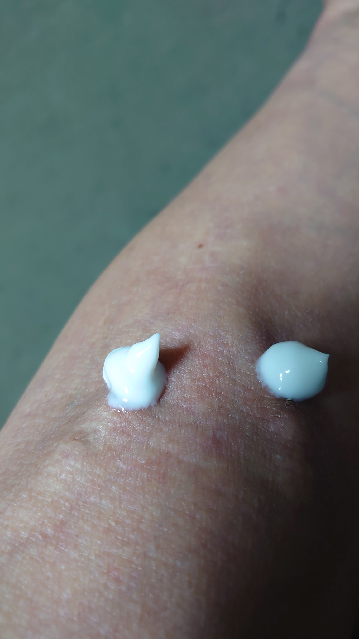 守山宿 Al Twitter 透析ルーティーン いつものように軽い麻酔が効くエムラクリームをてんこ盛り シールを貼って準備完了 これで透析モードに頭が切り替わる 正味4時間頑張る 透析準備 T Co Wyarwgxmtk Twitter