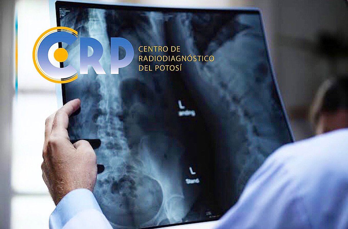 crp_slp's tweet photo. Él no es adivino, pero sabe exactamente cómo y por qué te duele la espalda 🤕

Los RADIÓLOGOS del Centro de Radiodiagnostico del Potosí te ofrecen EXPERIENCIA, CONOCIMIENTO Y EL MÁS ALTO NIVEL DE FORMACIÓN 👨🏻‍⚕️

📞 Agenda tu cita al 4447096998 ☎️ https://t.co/lGUwRhw0nf