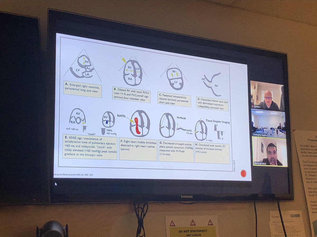 Last day for this week of CVS for our Prince George based <a href="/BC_EHS/">BC Emergency Health Services</a> <a href="/critcare_medics/">BCEHS Flight Paramedics</a>. Todays topics cover aortic injuries, PE, RV injury, endocarditis, tamponade and #criticalcare anesthesia considerations with right heart effects. <a href="/_Brian_Mc_/">Brian McNamara</a> <a href="/FAB_2016/">FAB2016</a>