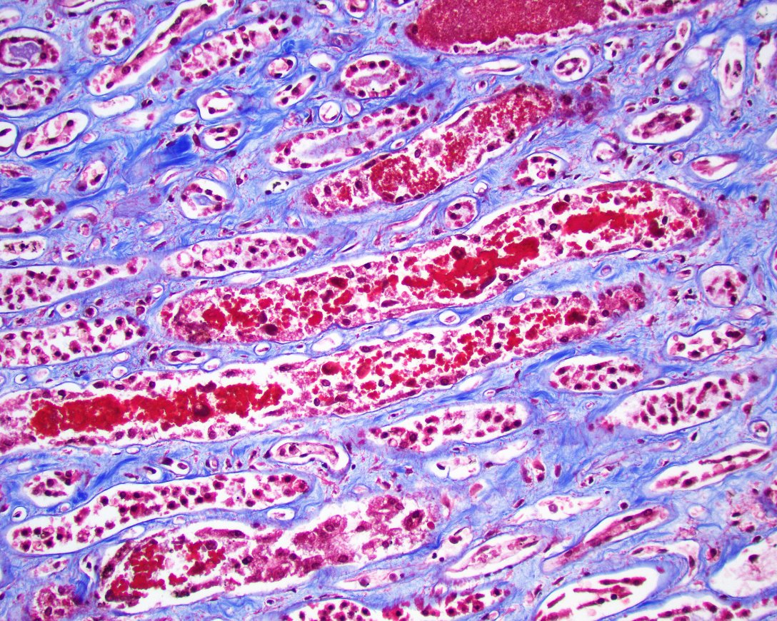 Jonathan Zuckerman MD PhD tweet media