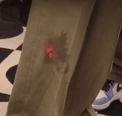 _dark_and_wild_'s tweet photo. @BTSupdate_7 Is it only me or somebody else also noticed this red spot on Taehyung's pants...😶😶 https://t.co/GH1KoMlGGL