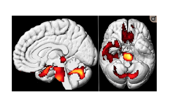 Leseerlaubnis's tweet image. Weil zu wenige Menschen die neurologischen Folgen von Covid-19 kennen, sammle ich diese hier in einem Thread.
In den nachfolgenden Tweets sind Einzelmeldungen und Threads enthalten, die man dann weiter aufklappen kann.
Bitte teilen Sie die Infos. Danke.